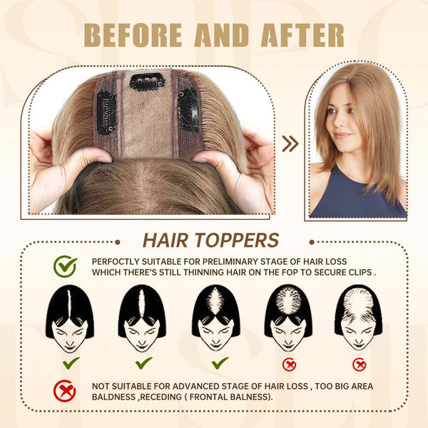Crown Topper