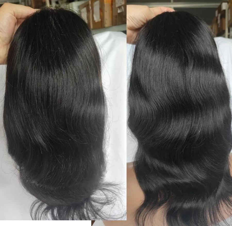 Hair Replacement For Men