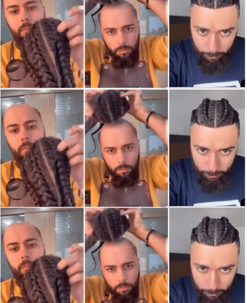 Hair Replacement System